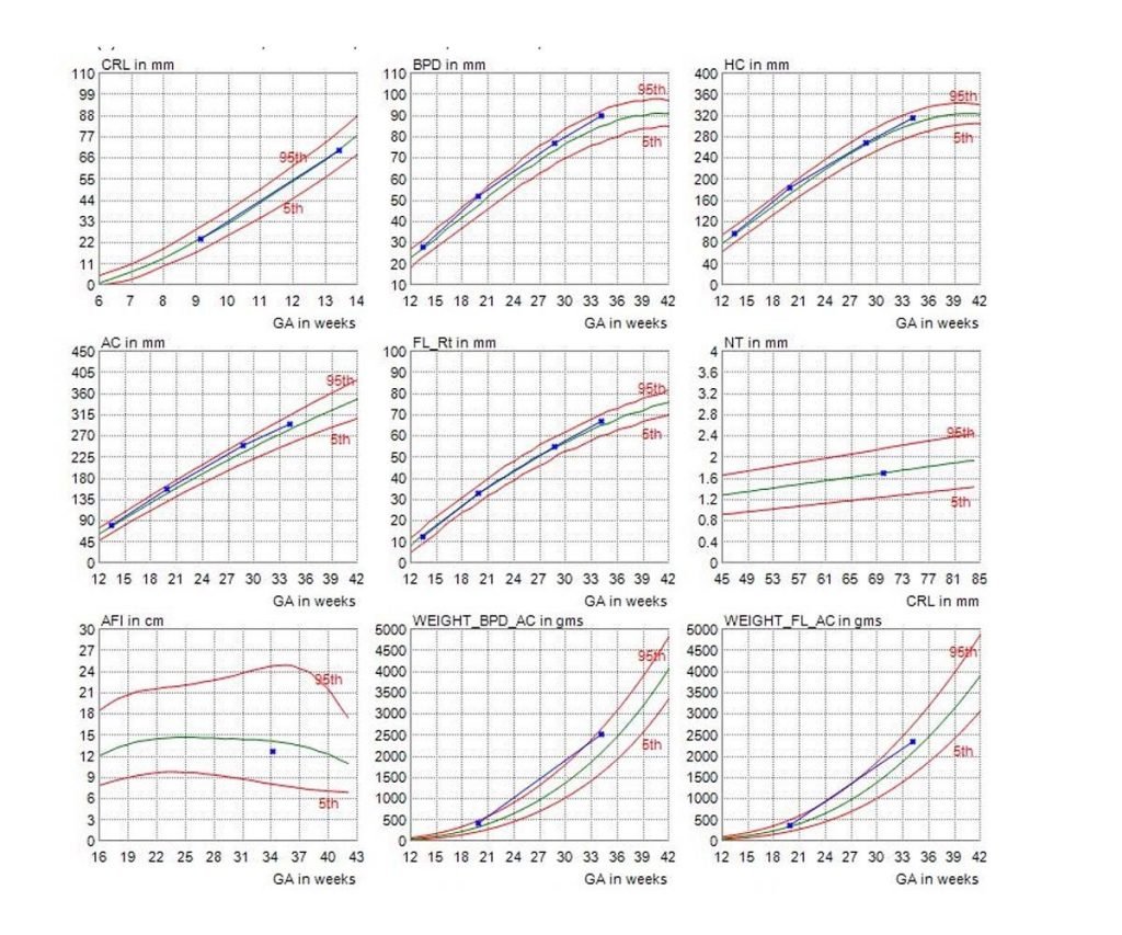 Growth Scan Report