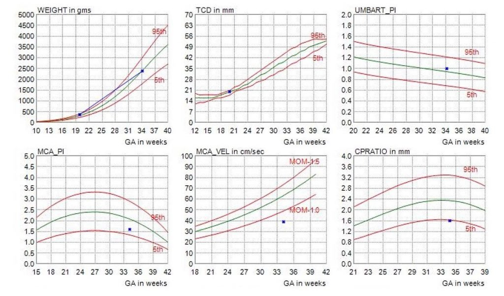 GROWTH SCAN GRAPH 