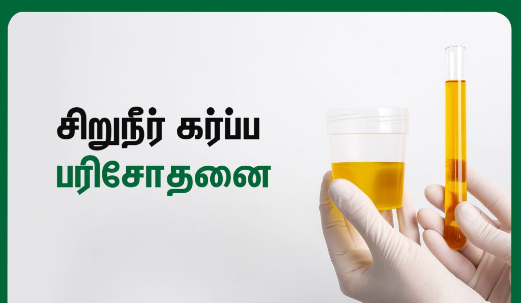 வீட்டில் கர்ப்பத்தை உறுதி செய்வது எப்படி? 8 urine pregnancy test