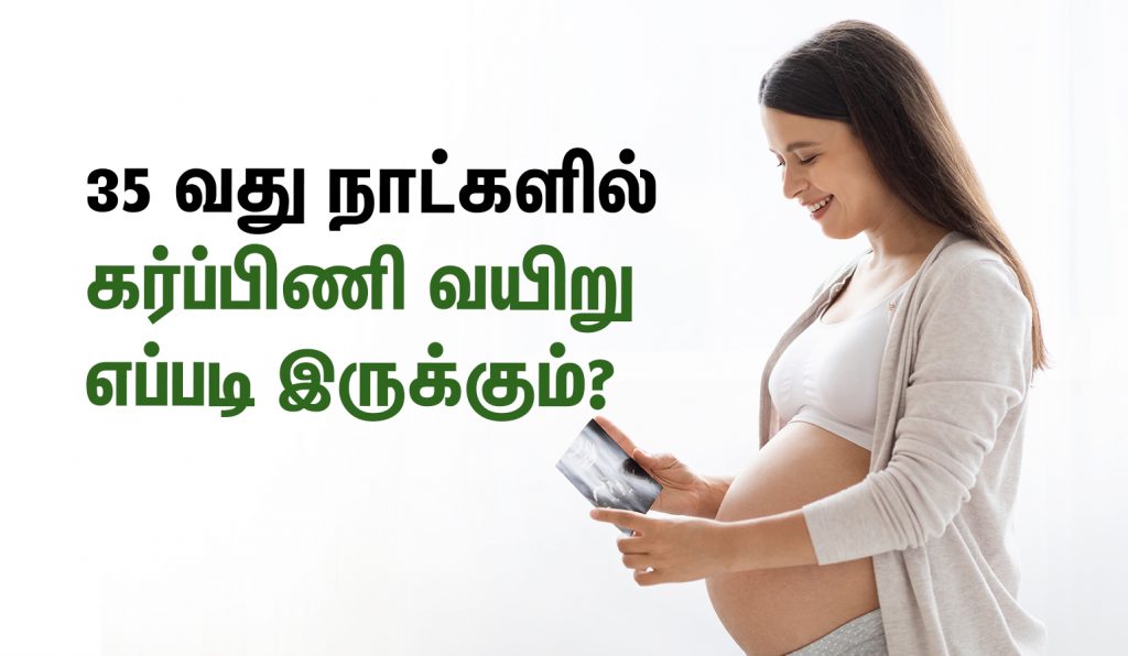 35 days pregnancy belly