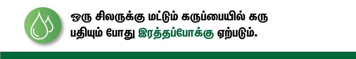 implantation bleeding