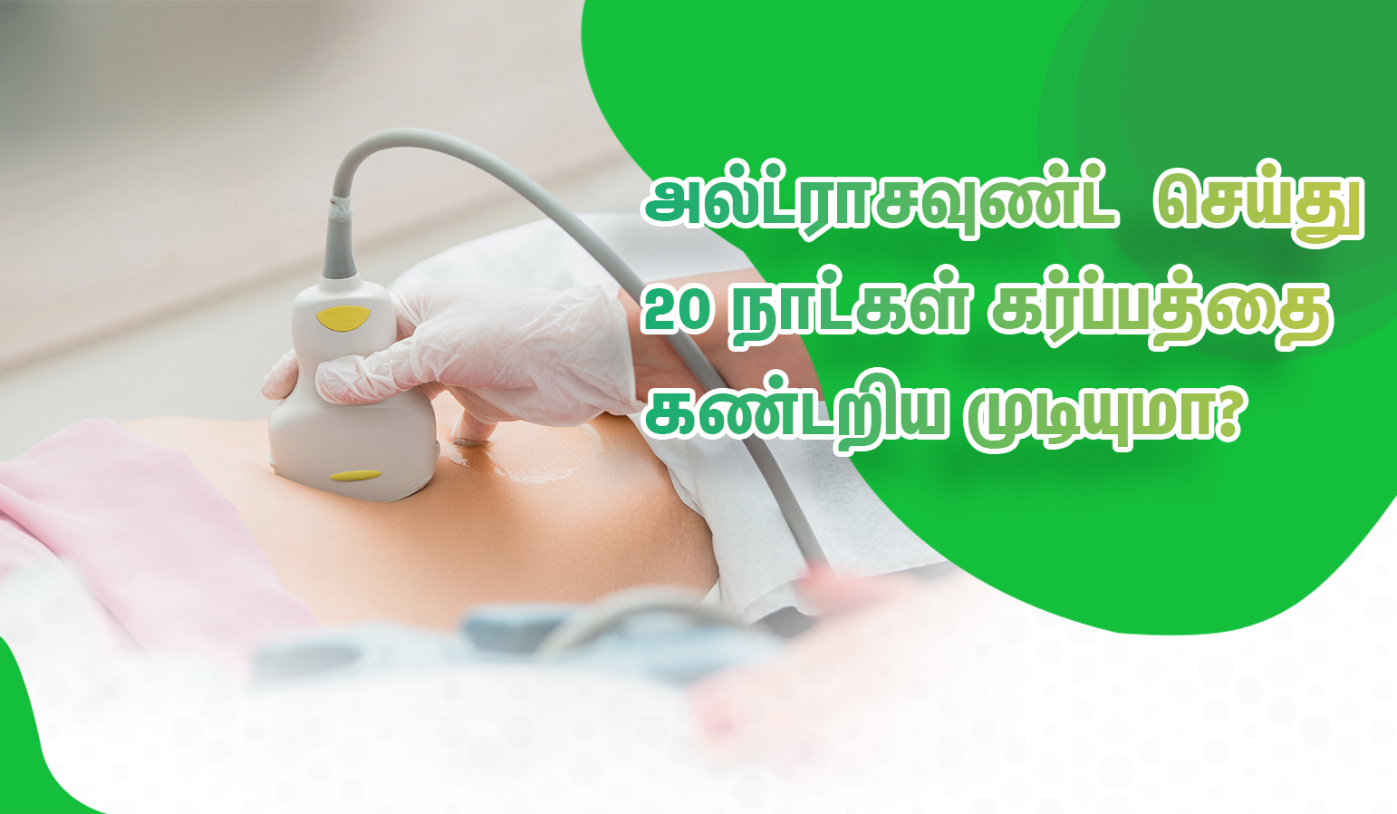 ultrasound scan for 20 days