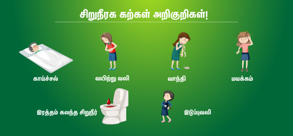 kidney stones symptoms