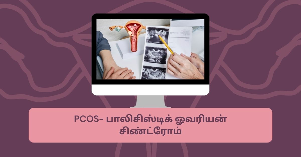 PCOS மற்றும் PCOD இரண்டும் ஒன்றா ?.. என்ன வித்தியாசம்? 4 PCOS